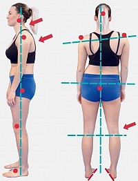 Pain Avoidance Posture